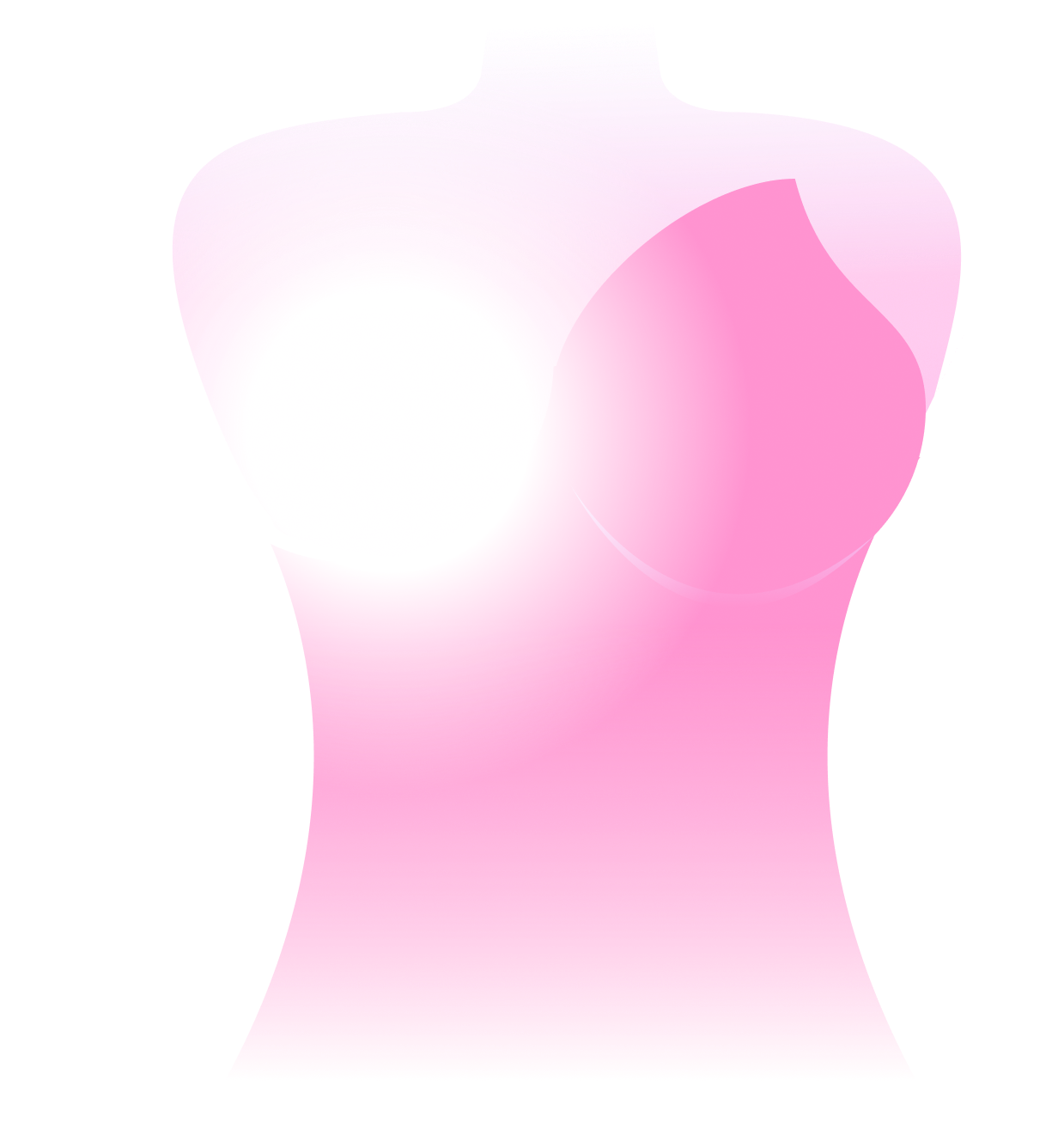 Breast Cancer visual
